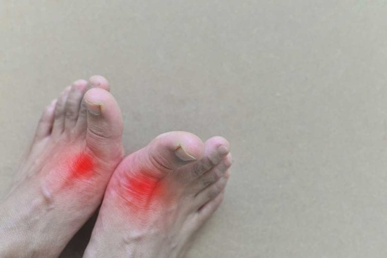 A man showing his bare feet that are in pain and is participating in a clinical research study.