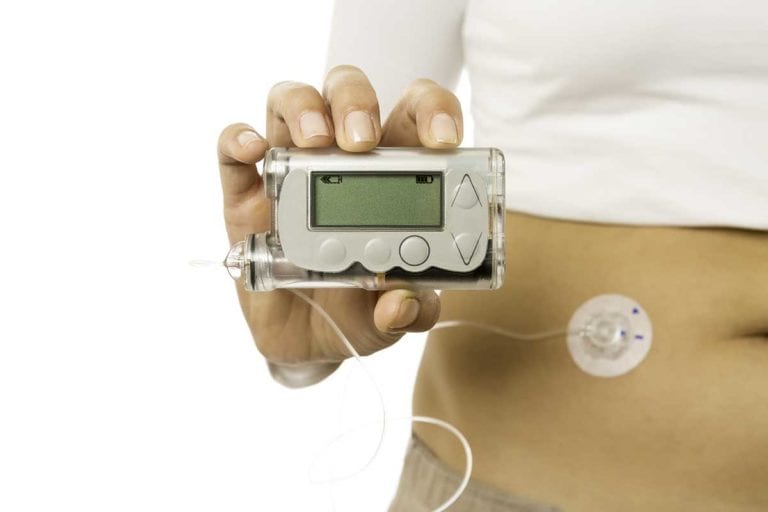 Woman holding an insulin pump and is participating in a diabetes related clinical research study.